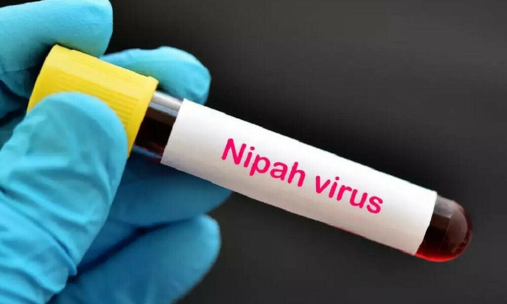 Thái Lan tăng cường kiểm soát dịch bệnh ở các sân bay trước nguy cơ virus Nipah